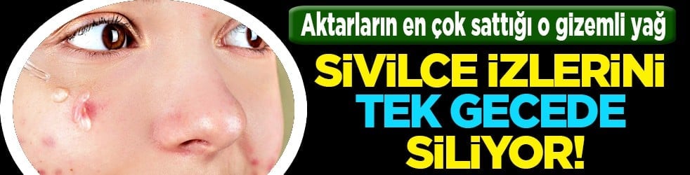 Tam bir çözüm metodu: Sivilce izlerini tek gecede siliyor! Aktarlarda kapış kapış satılıyor...