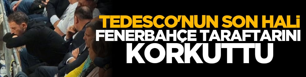 Tedesco'nun son hali Fenerbahçe taraftarını korkuttu
