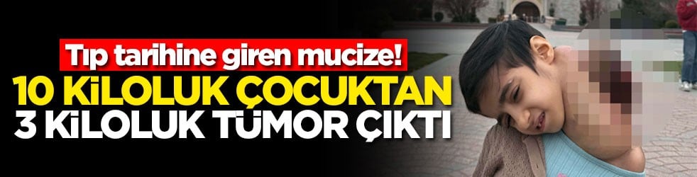 Tıp tarihine giren mucize! 10 kiloluk çocuktan 3 kiloluk tümor çıktı