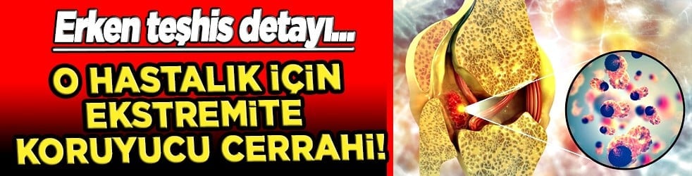 Tümör belasının önüne geçecek koruyucu cerrahi: Kemik tümörlerinde yeni dönem