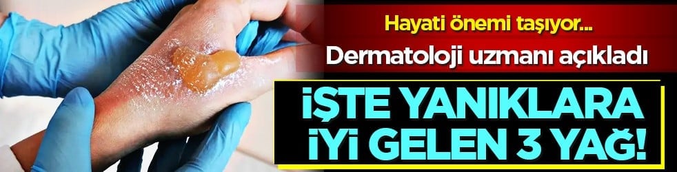 Yaraya yağ sürülür mü? İşte yanıklara iyi gelen 3 yağ! Dermatoloji uzmanı açıkladı