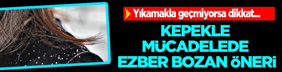 Yıkamakla geçmiyorsa dikkat: Kepekle mücadelede ezber bozan öneriye kulak tıkamayın!