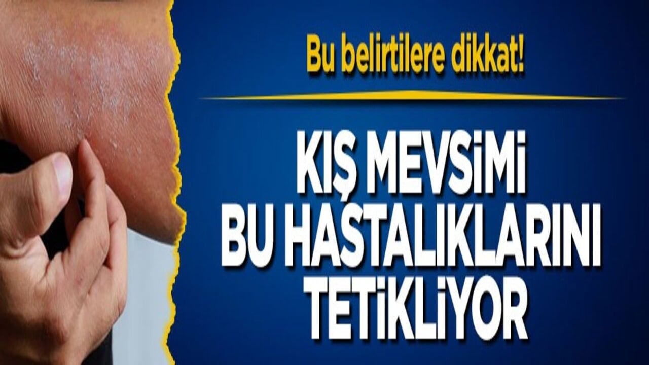 Bu belirtilere dikkat! Kış mevsimi bu hastalıklarını tetikliyor
