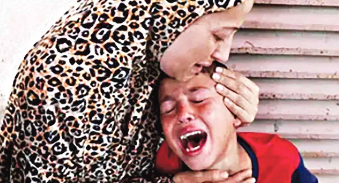 İnsan hakları mı? Sahnedeki palyaçolar, kulisteki katiller