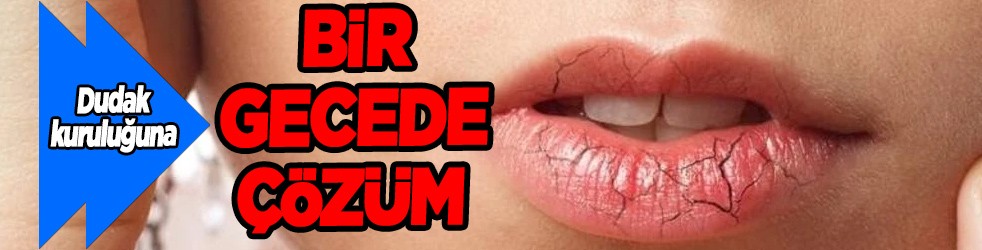 1 gecede dudak kuruluğuna çözüm! Yapmayan tam manasıyla bin pişman: B1,B2 ve B3 sorunu olabilir