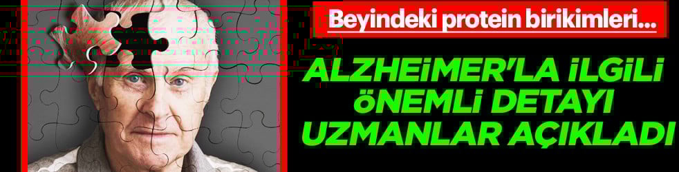 Alzheimer'la ilgili önemli detayı uzmanlar ortaya çıkardı!