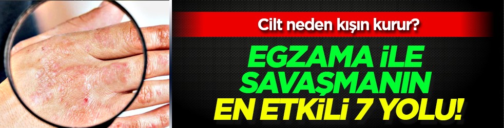 Cilt kuruyor! Kış aylarında egzama ile savaşmanın en etkili 7 yolu...