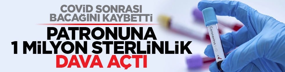 Covid sonrası bacağını kaybetti: Patronuna 1 milyon sterlinlik dava açtı