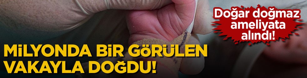 Doğar doğmaz ameliyata alındı! Milyonda bir görülen vakayla doğdu!