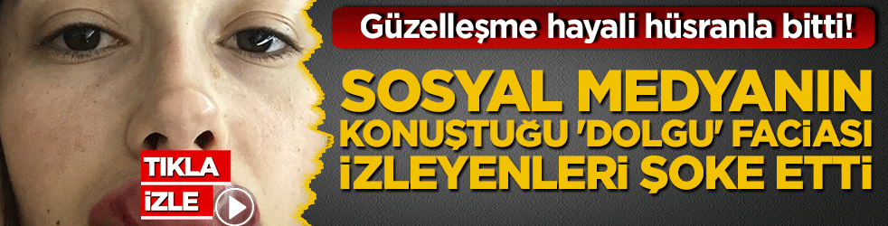 Güzelleşme hayali hüsranla bitti! Sosyal medyanın konuştuğu 'dolgu' faciası izleyenleri şoke etti