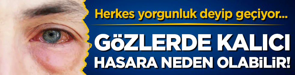 Herkes yorgunluk deyip geçiyor: Gözlerde kalıcı hasara neden olabilir!