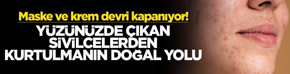 Maske ve krem devri kapanıyor! Yüzünüzde çıkan sivilcelerden kurtulmanın doğal yolu