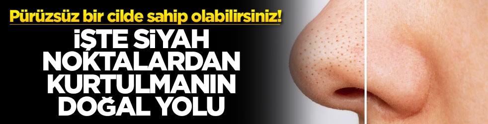 Pürüzsüz bir cilde sahip olabilirsiniz! İşte siyah noktalardan kurtulmanın doğal yolu