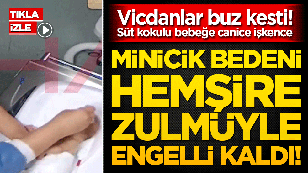 Vicdanlar buz kesti! Süt kokulu bebeğe canice işkence: Minicik bedeni hemşire zulmüyle engelli kaldı!