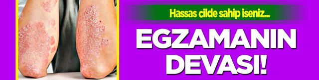 Hassas cilde sahip iseniz: Egzamaya şifa sabun: Tamamen doğal nemlendiriyor