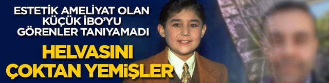 Helvasını &ccedil;oktan yemişler! K&uuml;&ccedil;&uuml;k İbo estetik ameliyatla bambaşka birine d&ouml;n&uuml;şt&uuml;