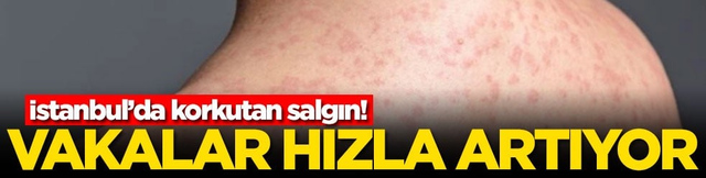 İstanbul&rsquo;da korkutan salgın! Vakalar hızla artıyor