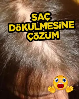 Saç dökülmesine evde doğal ve bitkisel çözüm nasıl yapılır?