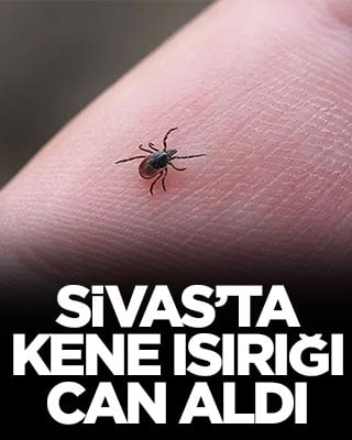 Sivas’ta kene ısırığı can aldı