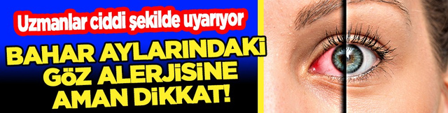 Uzman isimden &ccedil;ok ciddi uyarı! Bahar aylarındaki g&ouml;z alerjisi g&ouml;rme kaybına yol a&ccedil;abilir...
