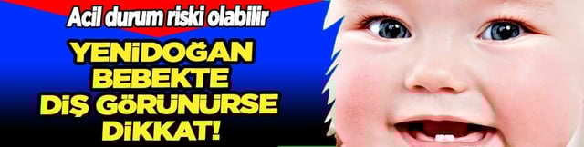 Yenidoğan bebekte diş g&ouml;r&uuml;n&uuml;rse dikkat! Bebeklerde bu sorun olmaya başladı
