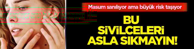 Hi&ccedil; hesapta olmayan gelişme olmasın! Bu sivilceleri asla sıkmayın! Masum sanılıyor ama b&uuml;y&uuml;k risk