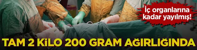 İ&ccedil; organlarına kadar yayılmış! Tam 2 kilo 200 gram ağırlığında
