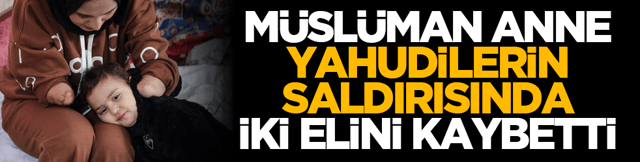 M&uuml;sl&uuml;man anne Yahudilerin saldırısında iki elini kaybetti