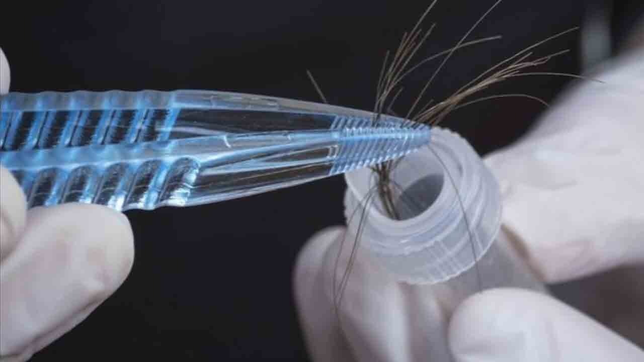 Adli Tıpta devrim: Saç telinden parmak izi hassasiyetinde kimlik