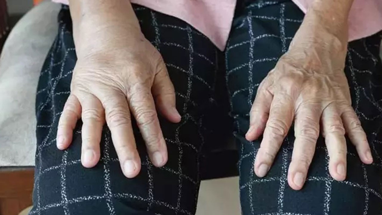 Aman bu belirtilere dikkat! Kadınlarda sık görülüyor ama çoğu farkında değil