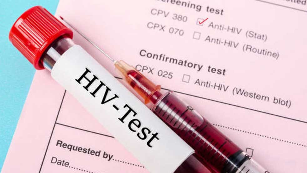 "Bağışıklık sistemini hedef alıyor" HIV tehdidi devam ediyor
