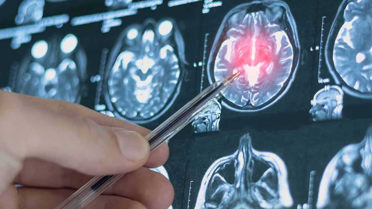 Beyin gelişiminde şaşırtan dönemler! Kritik yaşlar ortaya çıktı