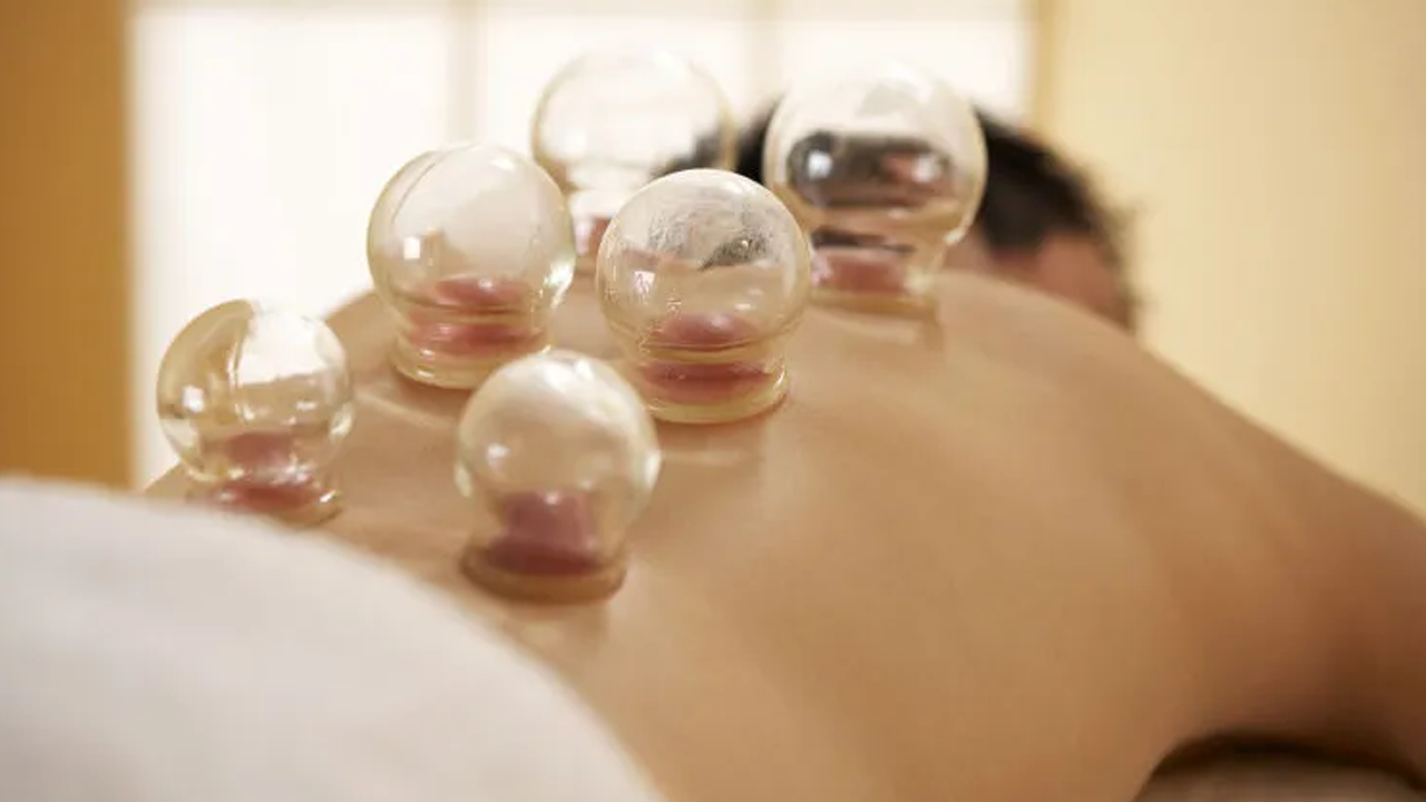 Binlerce yıllık tıp geleneği: Kupa tedavisi