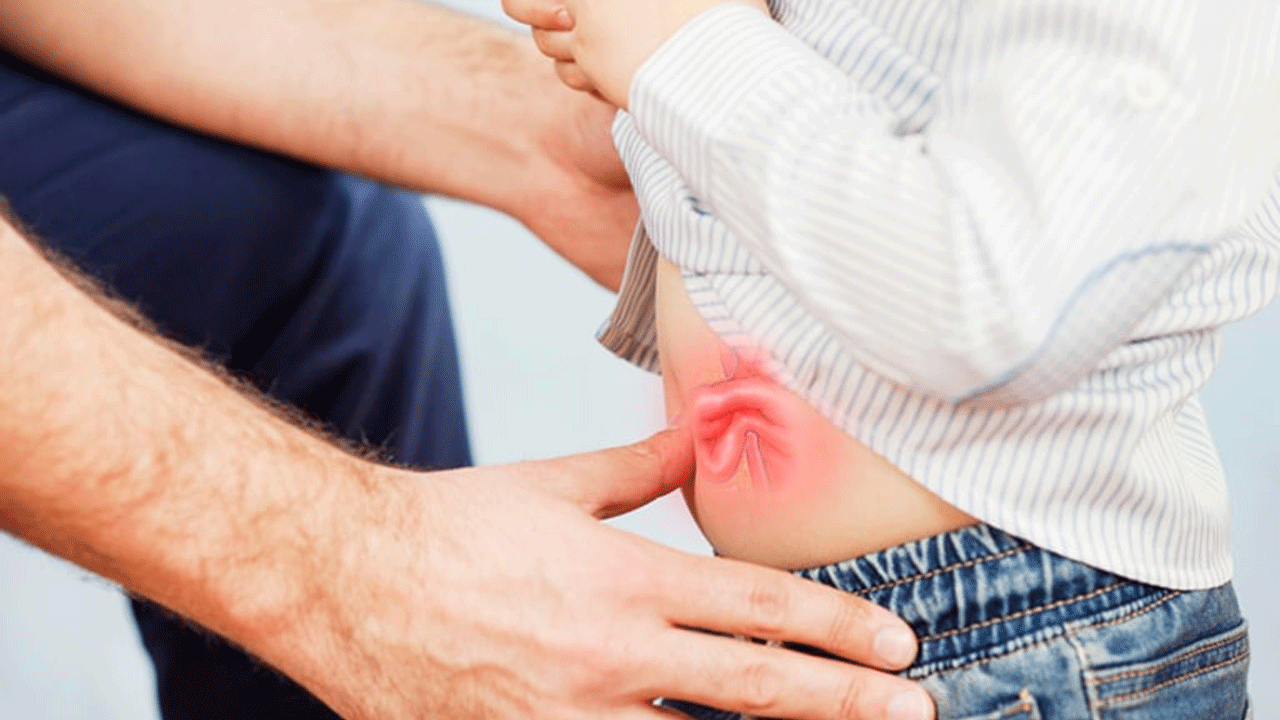 Çocuklarda kasık fıtığı tehlikesi! Kendiliğinden geçmez, tedavi şart