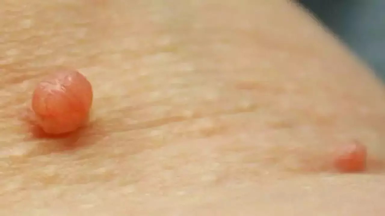 Et benlerini patır patır döken tarifler! Et benleri nasıl düşürülür? Hayati önem taşıyor, çabucacık düşer...