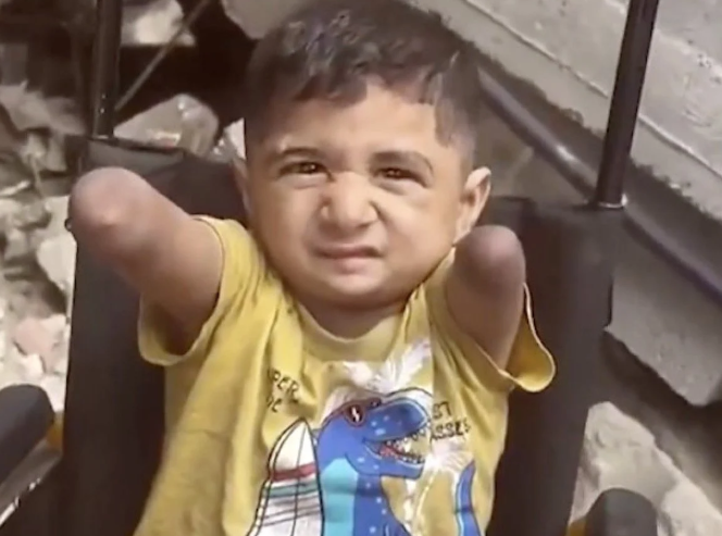 İslam dünyası bu zulmü sadece izliyor: İsrail Terörü küçük çocuğu bu hale getirdi!
