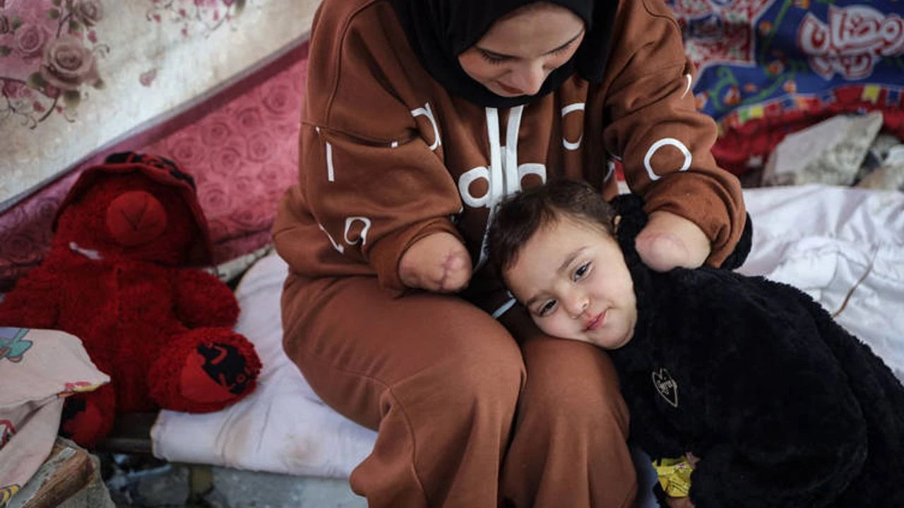 Müslüman anne Yahudilerin saldırısında iki elini kaybetti