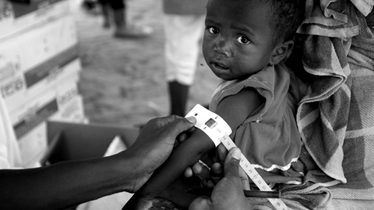 O ülkede bir ayda 23 çocuk açlıktan öldü!
