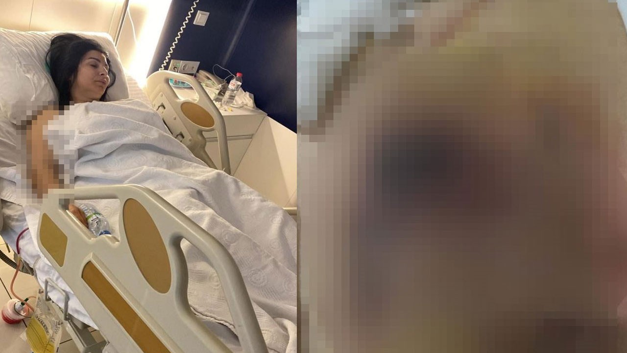 Popüler kültürün dayattığı güzellik algısı canından ediyordu! Ameliyat kabusa döndü