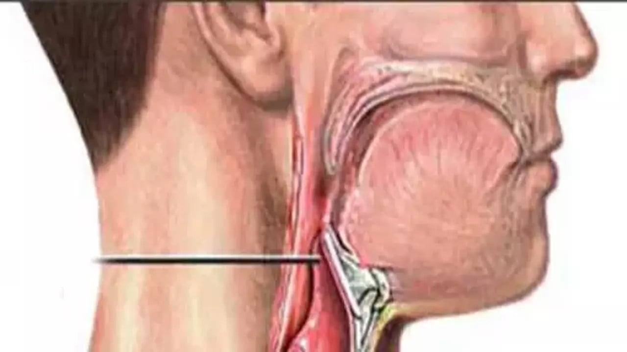 Soluk borusuna kaçan şeker nasıl çıkarılmalı? Böyle yapılıyor diyerek açıklandı