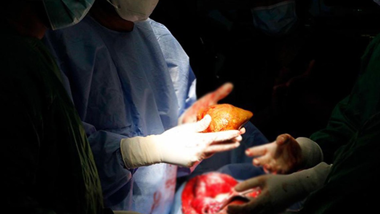 Tıpta devrim: Her kan grubuna uygun ‘evrensel böbrek’