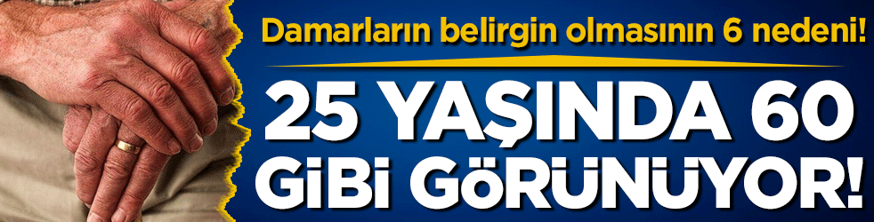 25 yaşında 60 gibi görünüyor: İşte damarların belirgin olmasının 6 nedeni!