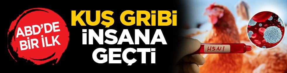 ABD’de bir ilk: Kuş gribi insana geçti