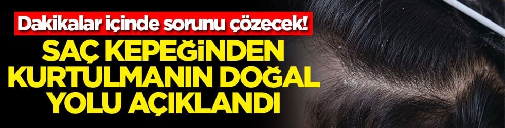 Dakikalar içinde sorunu çözecek! Saç kepeğinden kurtulmanın doğal yolu açıklandı