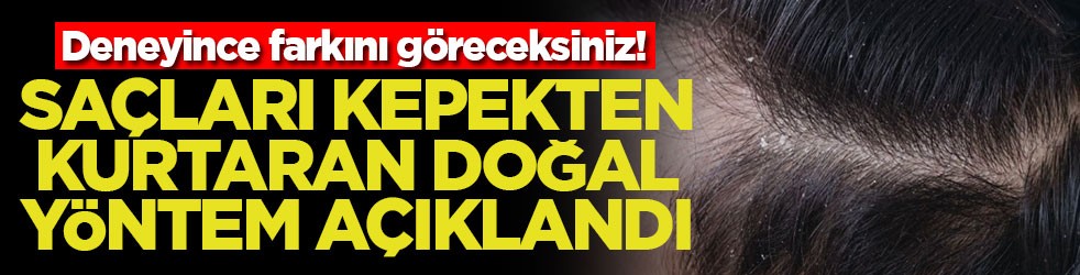 Deneyince farkını göreceksiniz! Saçları kepekten kurtaran doğal yöntem açıklandı