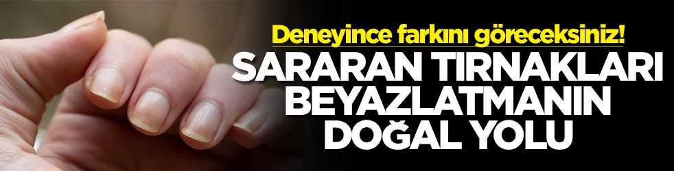 Deneyince farkını göreceksiniz! Sararan tırnakları beyazlatmanın doğal yolu