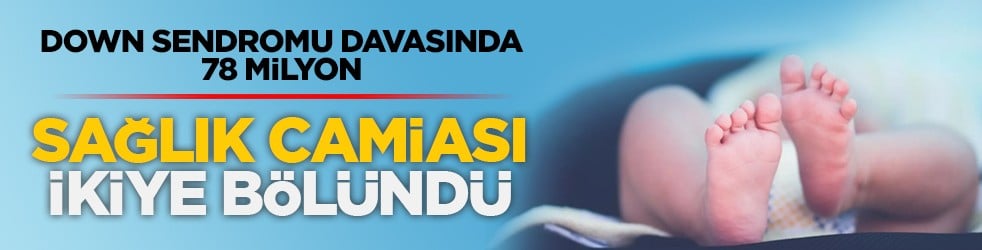 Down sendromu davasında 78 milyon: Sağlık camiası ikiye bölündü