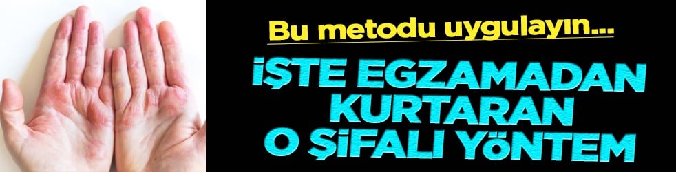 Egzamadan kurtaran en iyi doğal tedavi olacak: Çarpıcı yolu şaşırttı, görenleri hayrete düşürdü! Bakın nasıl yapılıyor