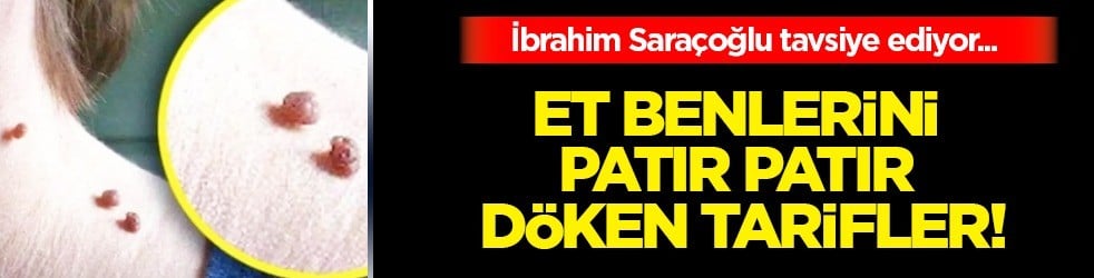 Et benlerini patır patır düşüren gizli kür tarifi Prof. Dr. İbrahim Saraçoğlu verdi: Haftada 2 kez kullanın diyor, önerisi bu