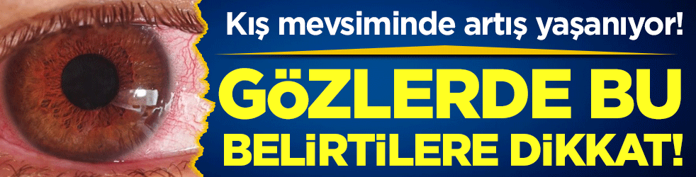 Kış mevsimi artış yaşanıyor: Gözlerde bu belirtilere dikkat!